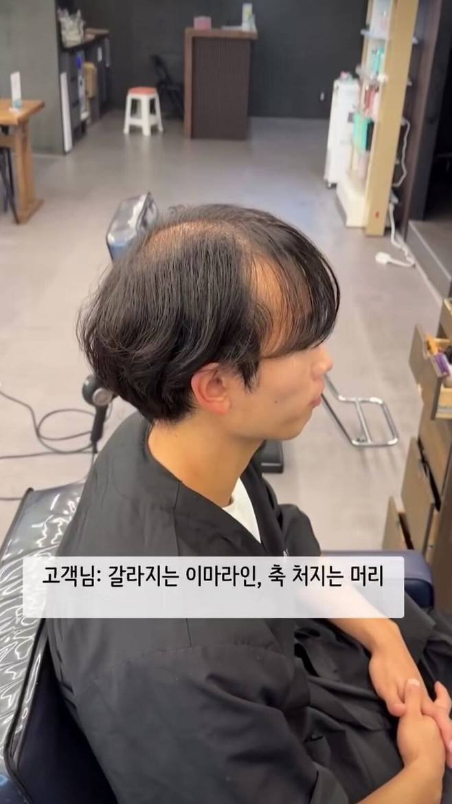 놀라운 탈모 커버업ㄷㄷㄷㄷㄷ