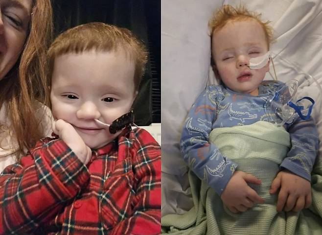 마일스 러브(3)는 ​종양 때문에 창백해진 안색이 머리카락 때문이라는 오해를 받​았다./사진=더 선