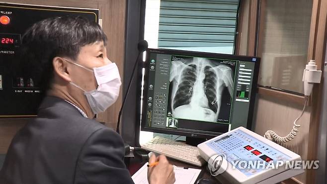 결핵 검진 [연합뉴스TV 제공]