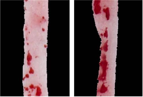 아스파탐 먹은 쥐(오른쪽)와 먹지 않은 생쥐의 동맥 플라크(빨간색) 비교 [Wu et al., Cell Metabolism 제공. 재판매 및 DB 금지]