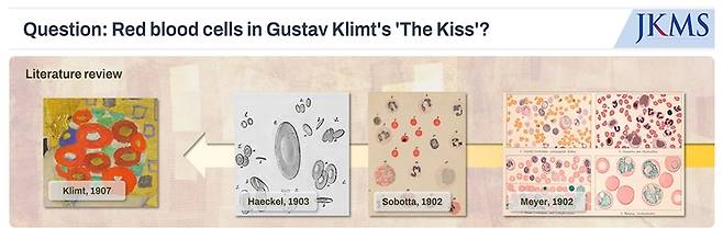[그림1][고대의대] ‘키스’ 그림 속 적혈구 관련 문헌조사