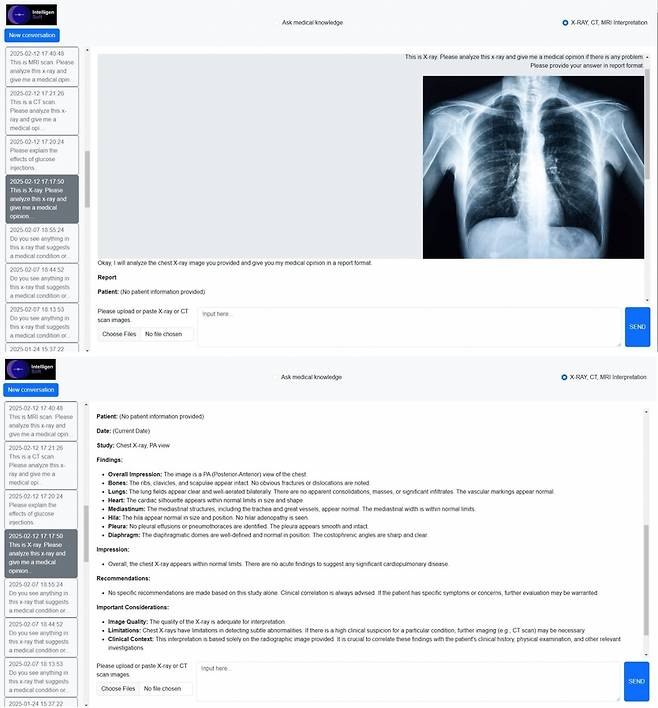 'MediVision AI' 솔루션 화면/사진제공=인텔리진소프트