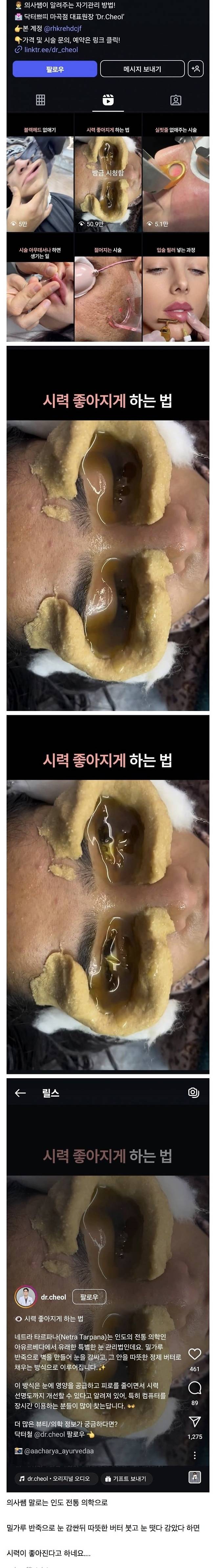 IMG_9077.jpeg 닥터 쁘띠가 알려주는 시력 좋아지는 방법