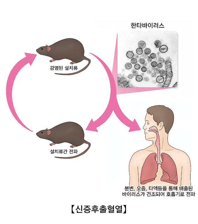 무제1375_20250221150308.png 나무위키 실검에 나왔던 한타바이러스에 대하여 알아보자