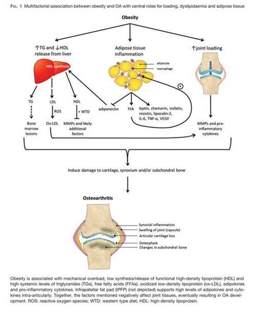 무릎 관절염은 비만으로 인한 기계적인 부하 뿐만 아니라, 몸의 염증 때문에도 잘 생긴다. [출처= E Thijssen, et al. Rheumatology 2015. 사진=송무호 제공]