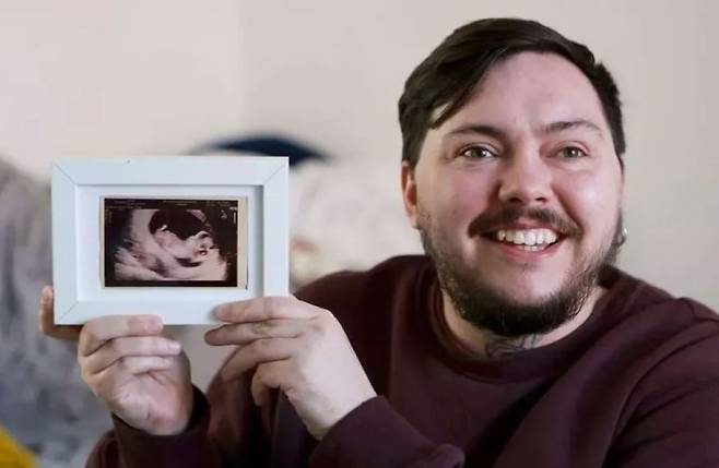 말라기 클라크가 초음파 사진을 들고 있는 모습/사진=더 미러