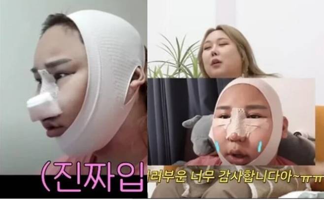 풍자는 자신이 성형 후 급격히 주목받았던 과거를 회상하며 솔직한 이야기를 전했다.[사진=유튜브채널 A급 장영란 ]