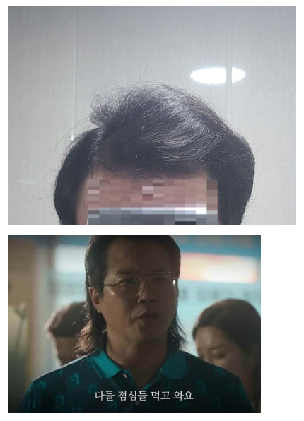 중간점검.PNG 펨붕이 탈모약 3개월 복용 후기.(마지막)