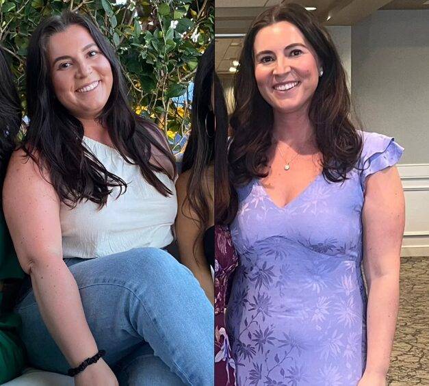 평소 건강하고 활동적인 생활을 해온 브리아나 아데소는 갑상선기능이 저하되어 6개월 만에 20kg 가까이 체중이 늘었다. [사진='데일리메일' 보도내용]