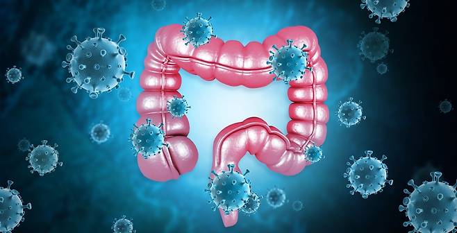대장암 발생 원인은 유전 인자부터 서구화된 식습관, 흡연, 음주, 스트레스 등 다양하다. 게티이미지뱅크