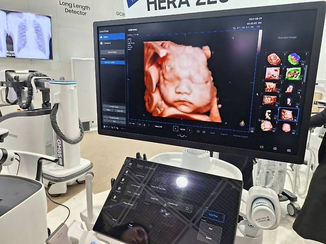 삼성메디슨의 산부인과 프리미엄 초음파 진단기기 HERA Z20의 포트레이트뷰 기능 시연장면. 안대규 기자