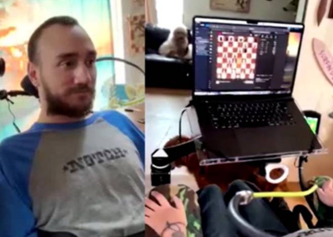 뉴럴링크 칩을 뇌에 심은 놀런드 아르보가 지난해 3월 생각만으로 체스 게임을 하는 모습을 최초로 공개했다.  뉴럴링크 X 캡처