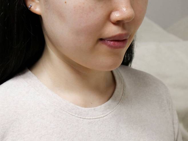 더 글로우 사용 직후 모습 / 출처=IT동아