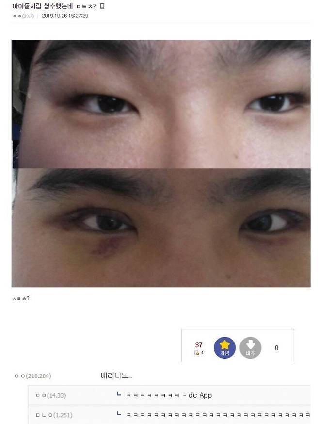 123.jpeg 아이돌처럼 쌍수했는데 ㅁㅌㅊ?