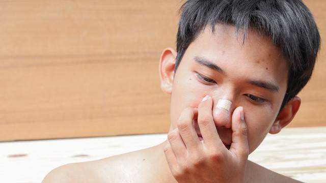 코뼈가 부러질 만큼 큰 충격이 가해졌다면 증상이 심하지 않더라도 검사를 받아보는 것이 좋다|출처: 게티이미지뱅크