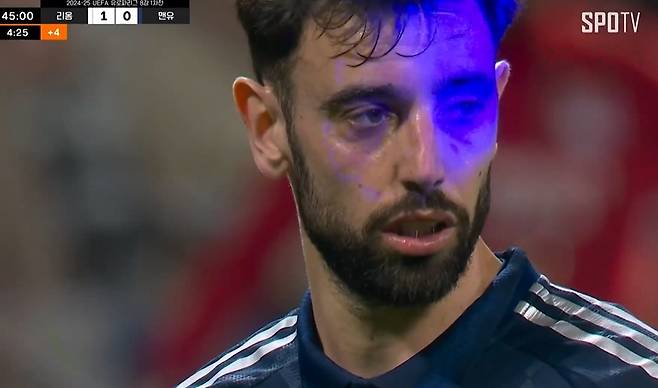 ▲ 페르난데스를 향해 레이저를 쏘는 리옹 팬들 ⓒ중계화면 캡처