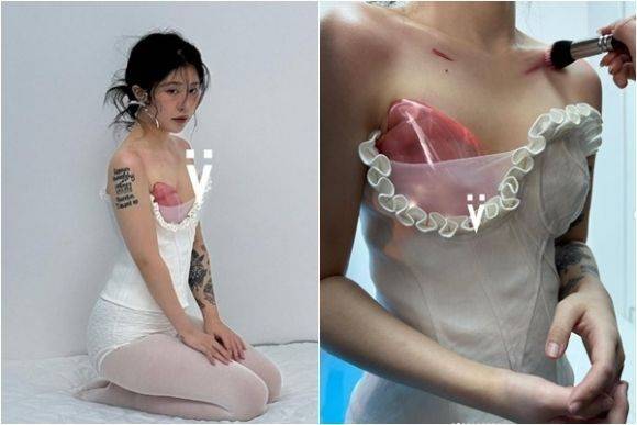 ‘폴란드 증후군’으로 인해 보석으로 만든 보형물을 착용한 중국인 여성 쉬안 자이. 보석 디자이너 이브민 사회관계망서비스(SNS) 캡처