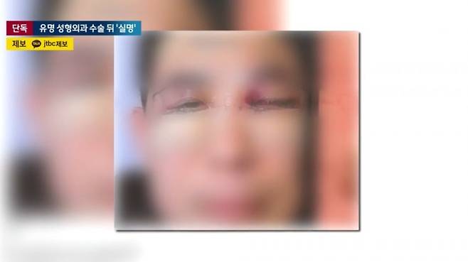 병원에서 눈 실명 시키고 한다는 말