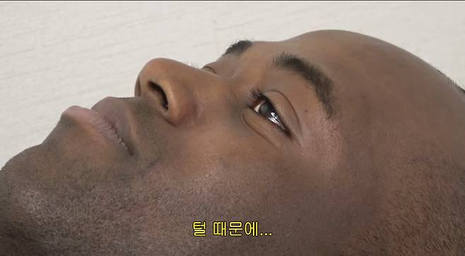 5.jpeg 조나단이 레이저 제모 못하는 이유.jpg