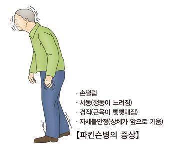 파킨슨병 [출처: 서울아산병원. 재판매 및 DB 금지]