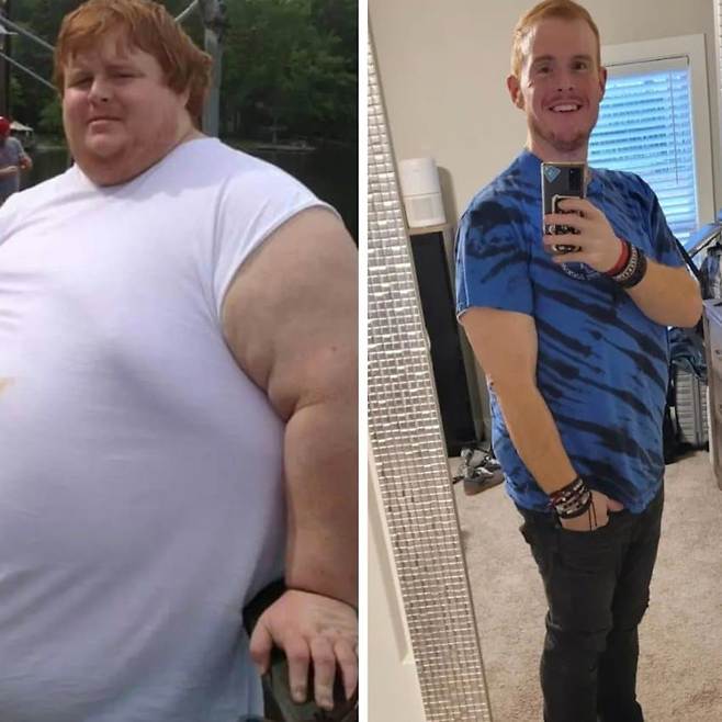 몸무게 322KG 미국인의 다이어트 도전기