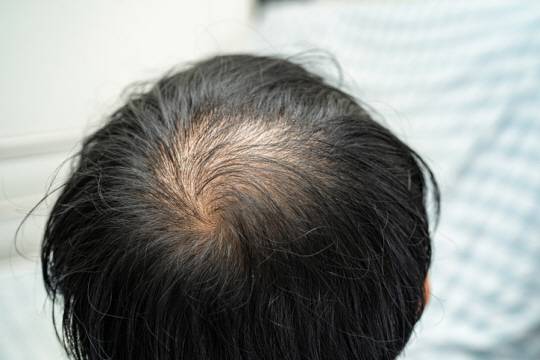 기사 내용과&nbsp;관련 없음. 게티이미지뱅크