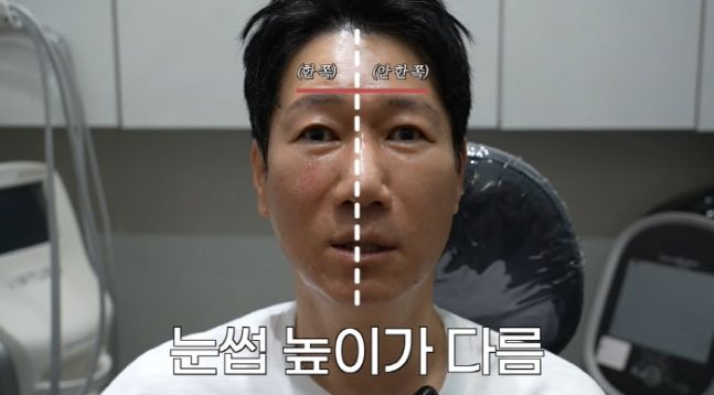 개그맨 지석진이 피부 시술 후 인상이 바뀐 모습을 공개했다. [사진=유튜브 채널 '지편한 세상']
