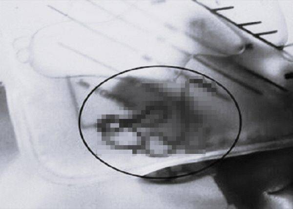 ⓒ임상 및 진단 연구 저널