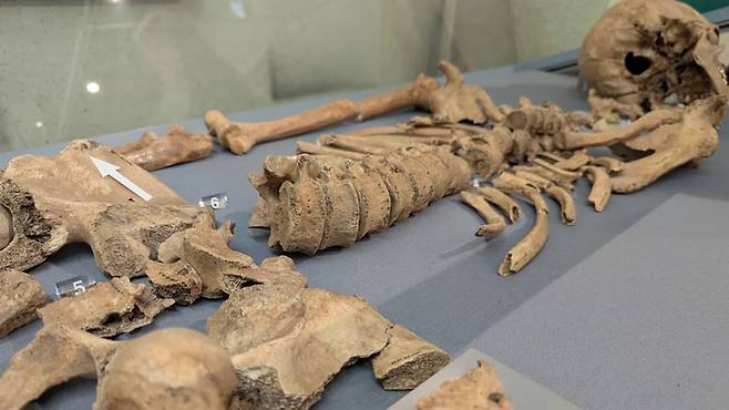 영국 요크 지역에서 발견된 검투사 유골. 골반에 이빨 자국이 남아 있다. 사진=요크대학교