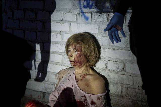 24일 우크라이나의 수도 키이우의 집에서 러시아의 포격으로 부상을 입은 여성이 자신의 집에 앉아 있다. AP 뉴시스