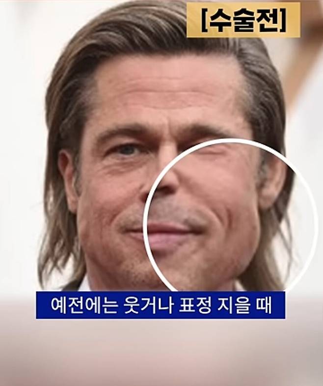 1000039182.jpg 성형외과 의사도 극찬한 1억 6천짜리 성형 받았다는 브래드피트 근황 ㄷㄷㄷ...jpg