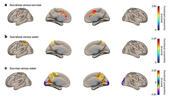 수크랄로스와 설탕(sucrose) 음료, 물 섭취 후 뇌의 변화 [네이처 메타볼리즘 논문 캡처]