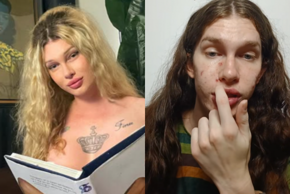 고양이처럼 변신하기 위해 1000만원이 넘는 비용을 들여 얼굴 시술을 받은 호주 인플루언서 졸린 도슨(29)이 “잘못된 이유로 절대 시술받지 말라”고 경고했다. 졸린 도슨 SNS 캡처