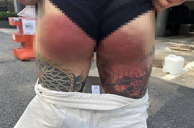 2022년 7월께 부평식구파 조직원 D씨로부터 야구방망이 폭행을 당한 후배 조직원의 엉덩이 모습. (사진 = 인천지검 제공)