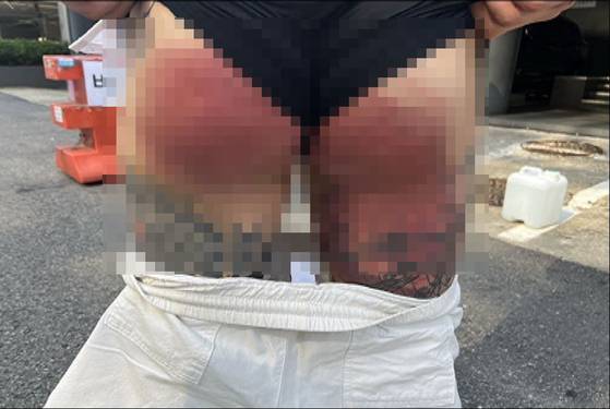 엉덩이를 폭행당한 폭력조직원. 인천지검 제공