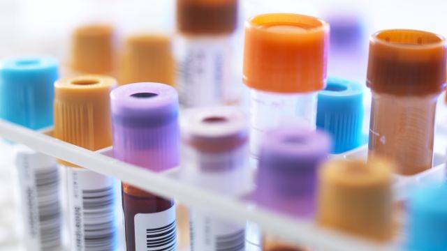 합병증 예방을 위해 혈액 검사, 소변 검사를 받아야 한다｜출처: 클립아트코리아