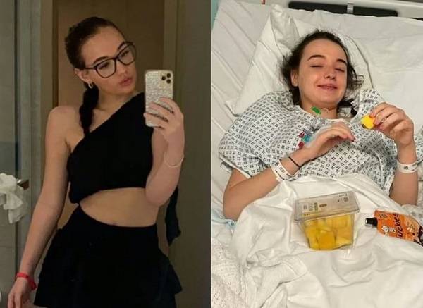 앨리사 보우맨(17)은 2023년 6월부터 극심한 갈증에 시달렸는데, 알고 보니 악성 뇌종양 증상이었다. 건강하던 시절 보우맨의 모습과 뇌종양 치료 중이던 모습/사진=Daily Express