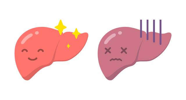 고지혈증 치료에 사용되는 스타틴 약물이 만성 간질환 환자의 간암 예방에 효과가 있다는 연구 결과가 나왔다. 사진은 기사의 특정 사실과 관련 없음. 게티이미지뱅크