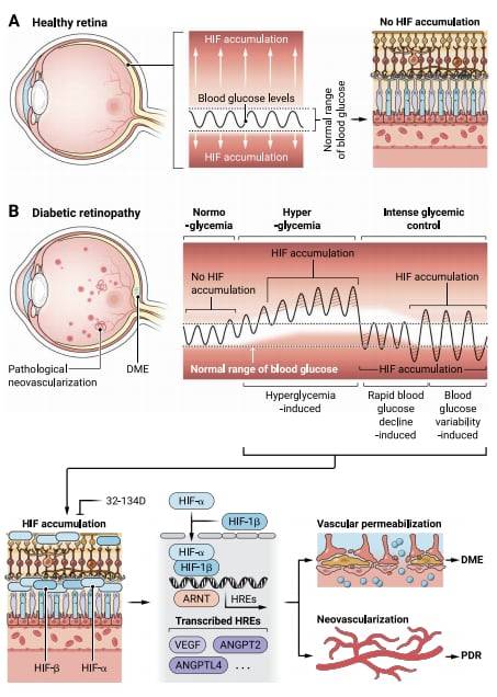 연구팀은 고혈당과 저혈당이 망막에서 HIF(저산소 유도 인자)의 축적을 유도하고, 그 결과로 VEGF(혈관내피성장인자)와 같은 혈관작용 인자들이 발현된다는 사실을 발견했다. 이 과정은 허혈(혈류 부족)과는 무관하게 발생한다. /사이언스 중개의학
