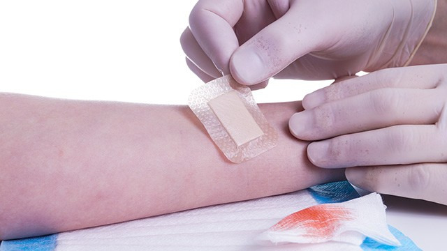 상처가 난 직후 초기 대응만 잘해도 흉터를 최소화할 수 있다｜출처: 클립아트코리아