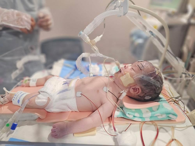 경기도 성남시 분당서울대병원 중환자실에 입원해 있는 윤솔(0)군이 뇌출혈 후 3일째 되던 날 '임종면회' 당시 찍은 사진. 안지은씨 제공