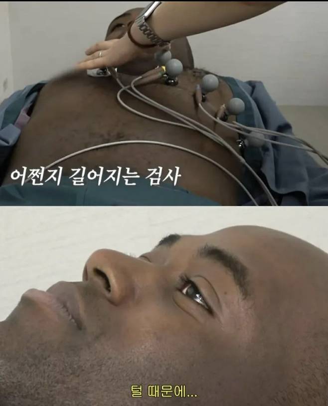 1000012122.jpg 조나단이 레이저 제모를 못하는 이유