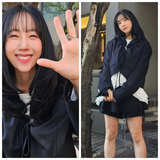 별이 밝은 미소 뒤에 숨겨진 건강 이상을 털어놨다.사진=별 SNS