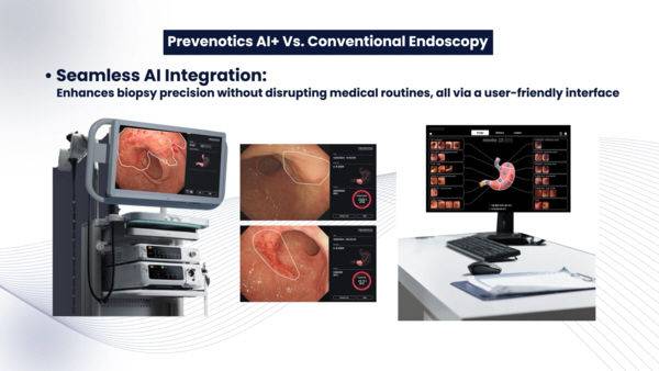 [서울=뉴시스] 2일 의료기기업계에 따르면 프리베노틱스가 개발한 '베노틱스-지프로'는 AI를 기반으로 소화기 암 분야에서 전조 증상을 잡아낸다. (사진=프리베노틱스 제공) 2025.05.02. photo@newsis.com *재판매 및 DB 금지