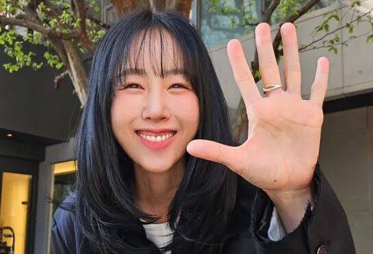 가수 별이 얼굴에 대상포진이 생긴 사실을 고백했다. [사진=별 인스타그램]