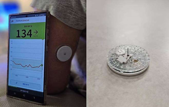 연속혈당측정기를 팔에 부착한 모습(왼쪽). 혈당 모니터링 앱을 통해 실시간 혈당 변화를 확인할 수 있다. 500원짜리 동전 정도의 크기로 일상생활의 큰 불편함은 없었다. 오른쪽은 2주간 사용한 연속혈당측정기. 센서에 달린 5.5㎜ 길이의 필라멘트는 단단하지 않은 소재로, 부착할 때 통증이 느껴지진 않았다.
