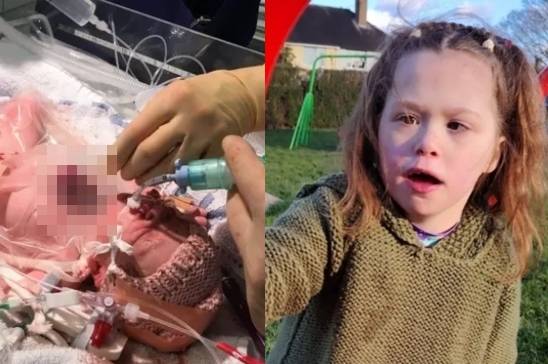 심장이 몸 밖으로 나온 채 태어난 영국의 7세 소녀가 흉부 재건 수술에 성공했다./사진=BBC 홈페이지