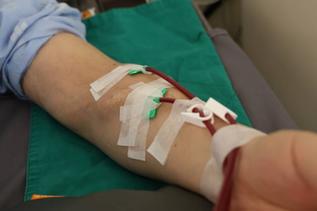 지난 4월 23일 부산 시내 한 병원에서 신장 이식을 기다리는 환자 오성옥(58) 씨가 투석 치료를 받고 있다. 우태욱 기자 woo@imail.com