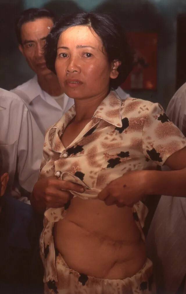 2001년 3월 베트남 퐁니 마을 자신의 집에서 1968년 2월12일 한국군의 총격 사실을 증언하는 응우옌티탄. 한겨레 고경태 기자