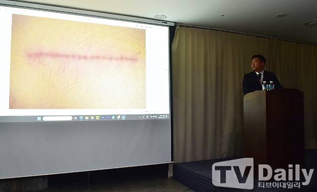 티브이데일리 포토